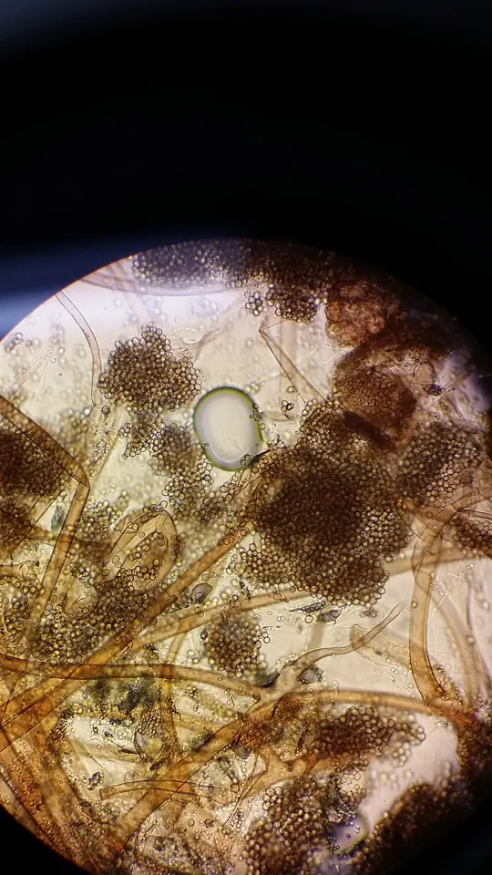 Hyphae, the filaments of which a fungus is made, seen under the microscope in a living fungus. Fungi leave almost nothing but these filaments in the fossil record.