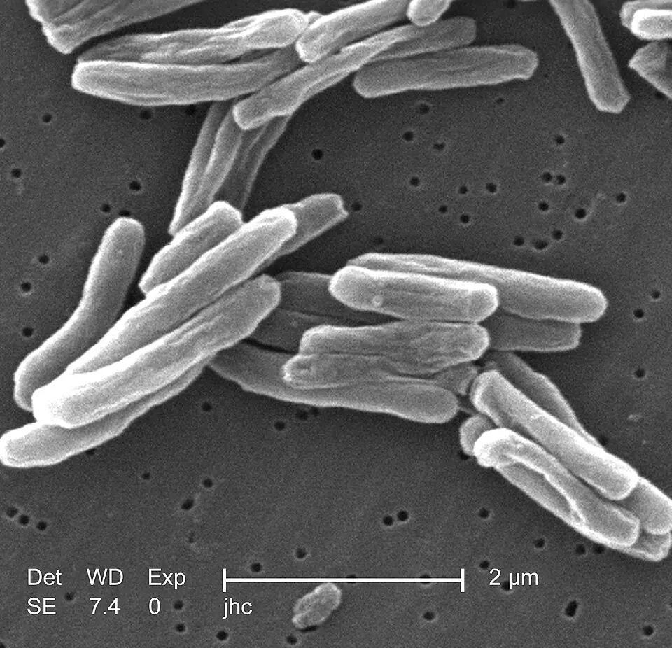 Mycobacterium tuberculosis, the bacillus of tuberculosis, under the scanning electron microscope, magnified about 15,500 times.