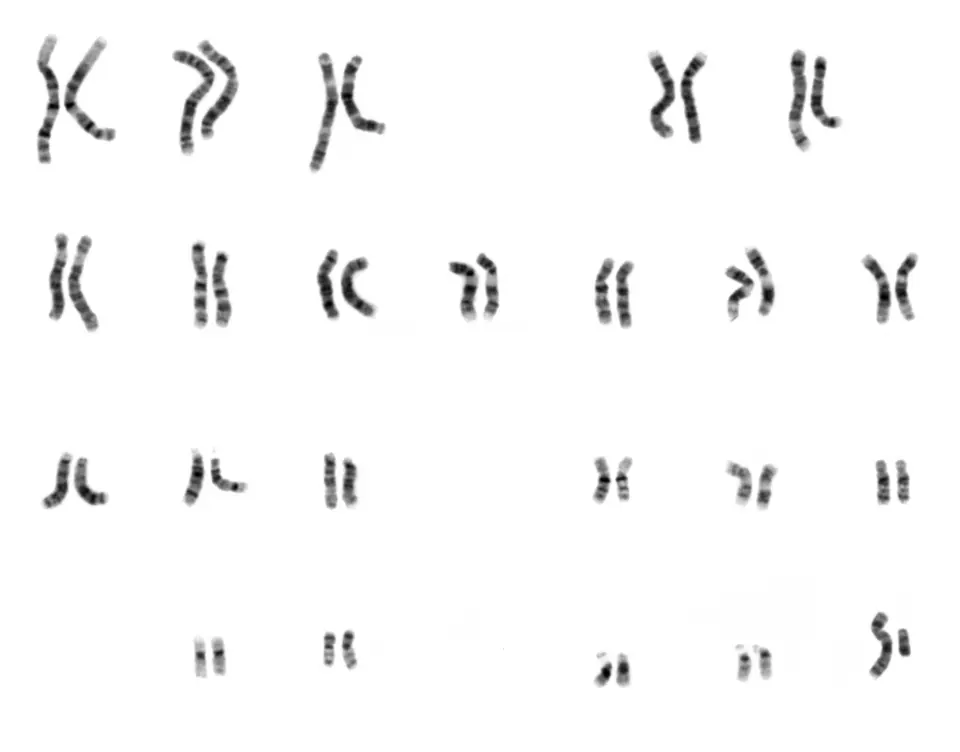 Karyotype of a human male: the chromosomes of one cell, photographed and arranged in pairs.