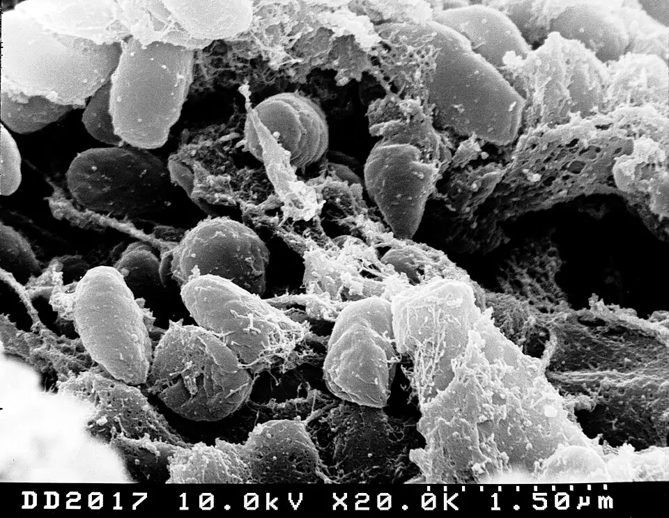 Yersinia pestis, la bactérie de la peste, dans la partie antérieure du tube digestif d'une puce, au microscope électronique à balayage.