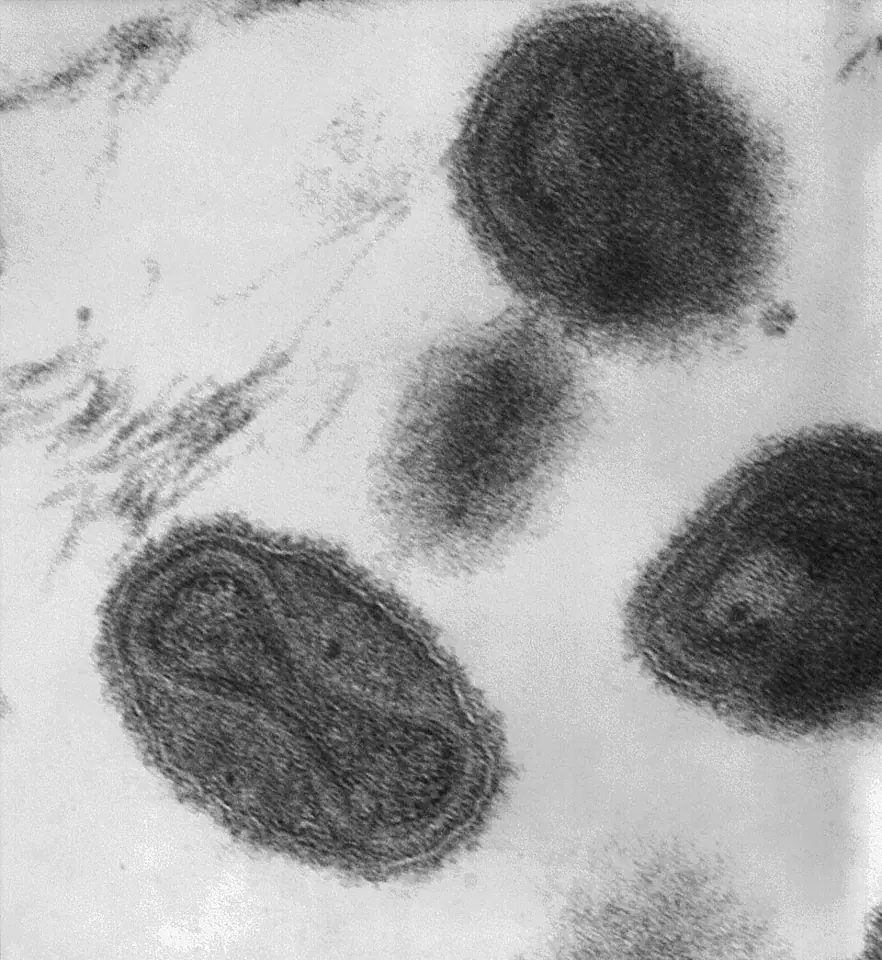 Particles of the smallpox virus under the transmission electron microscope, magnified about 370,000 times. The dumbbell-shaped core inside each holds the viral DNA.